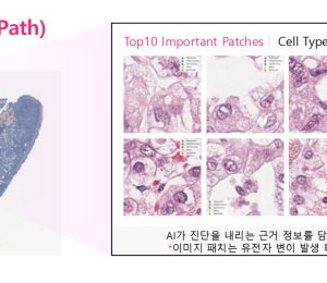 LG, 차세대 의료 AI '엑사원 패스' 공개