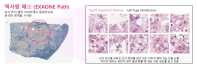 LG, 차세대 의료 AI '엑사원 패스' 공개